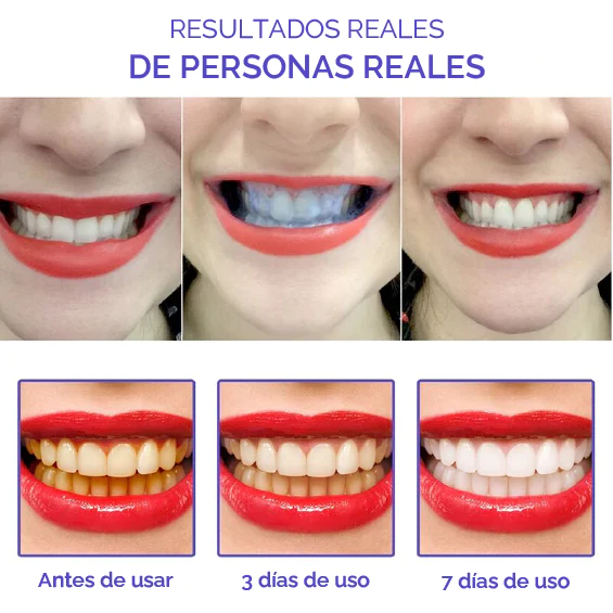 Smilekit espuma morada blanqueadora